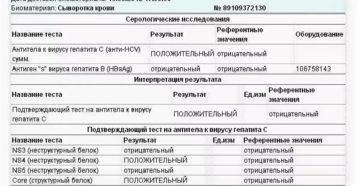 Гепатит с почему антитела и отрицательный пцр