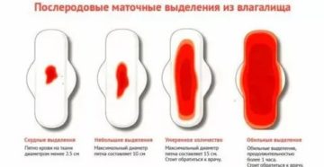 Задержка вторых месячных после родов