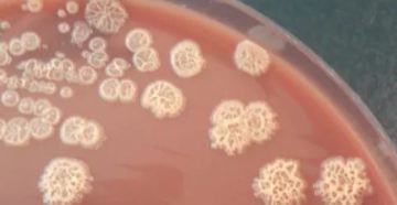 Pseudomonas stutzeri Pseudomonas stutzeri