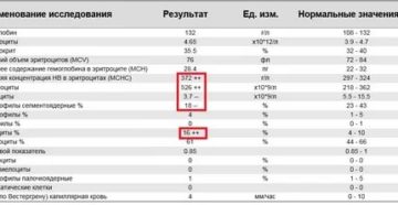 Понизились тромбоциты на 130