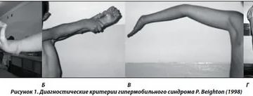 Как то не естественно выгибаются локти