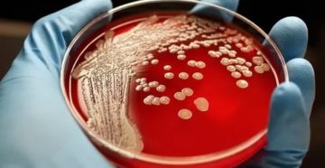 Staphylococcus aureus в бак посеве