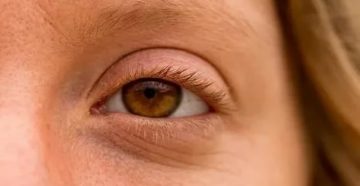 Закрываю веки глаза бегают