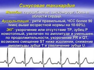 Хроническая тахикардия после испуга