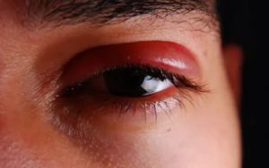 Красная полоса, щиплет глаза от натуральной слезы