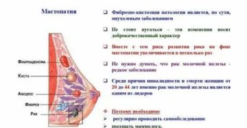 Флюорография при фиброзно-кистозной мастопатии