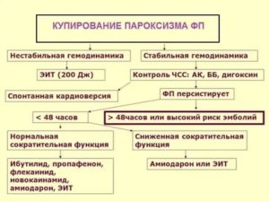 Купирование приступа мерцательной аритмии