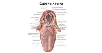 Мешают на корне языка какие-то наросты