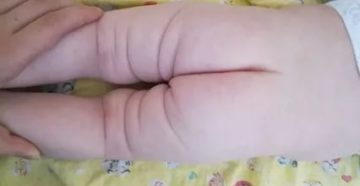 Не сходятся складки на ножках