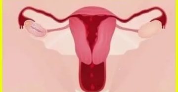 Месячные только после секса