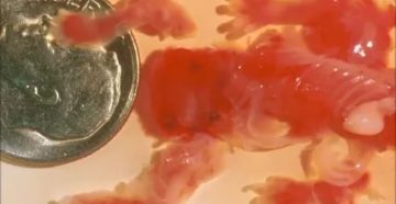 Медикаментозный аборт при замершей беременности