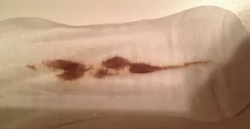 Мажущие выделения уже 9 дней