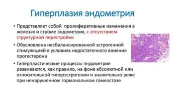 Гиперплазия эндометрия. Бусерелин + мирена