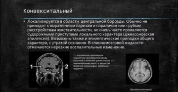 Нерезкое расширение конвекситальных ликворных пространств