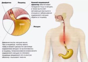 Боль и сильное жжение в пищеводе и желудке. Что делать?