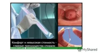 Спираль стоит очень долго, начались выделения