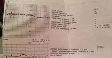 Что значат высокие эпизоды в КТГ?