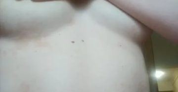 Пятна в области рёбер, на грудной клетке