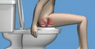 После секса больно ходить в туалет