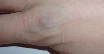 Непонятные болячки на руках и ногах