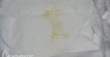 Коричневые выделения из влагалища, девочка 2 года