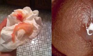 Кровянистые выделения после спринцевании. Такое бывает?