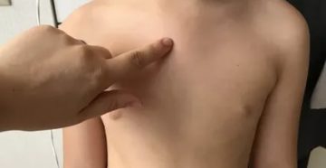 Выпирает грудная клетка