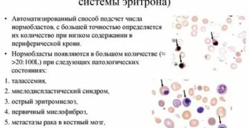 Появление в крови нормобластов