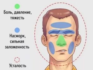 Давит в области носа