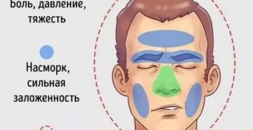 Давит в области носа Давит в области носа