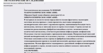 Помощь в расшифровке пайпель биопсии