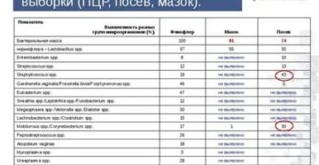 Streptococcus spp в анализе мочи на скрытые инфекции