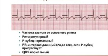 Блокада 1 степени у ребенка