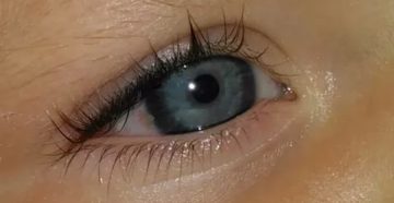 Прыщ на глазном яблоке у грудничка