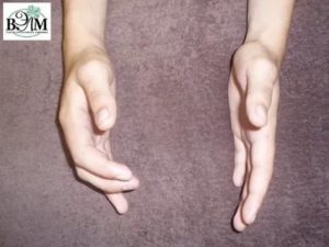 Кривой и болит палец после перелома