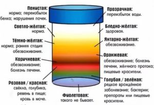 Как понять, моча или воды?