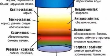 Как понять, моча или воды?