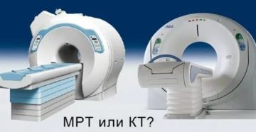 Что лучше МРТ или КТ