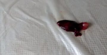 Кровянистые выделения 3 недели