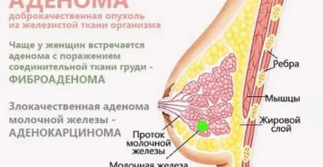 Болит грудь в одном месте