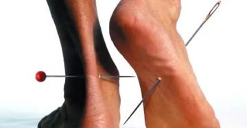 Чувство, как будто ноги обтянуты жгутом Чувство, как будто ноги обтянуты жгутом