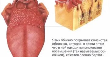 На корне языка и сбоку появились прыщи в виде волдырей