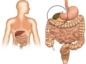 Застой желчи