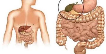 Застой желчи Застой желчи
