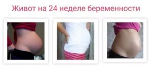 Болит живот 24 недели беременности
