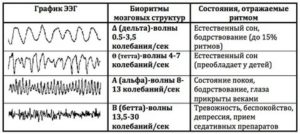 Расшифровать результаты ЭЭГ, РЭГ