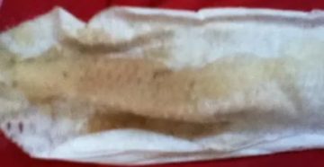 Кровянистые выделения во время приема жанина