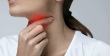 Сухость горла после ангины