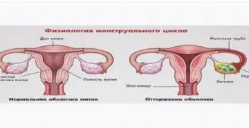 Задержка менструации, секс во время месячных