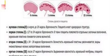 Преждевременно старение плаценты 1-2 степени, срокбер 31 неделя. Что делать?